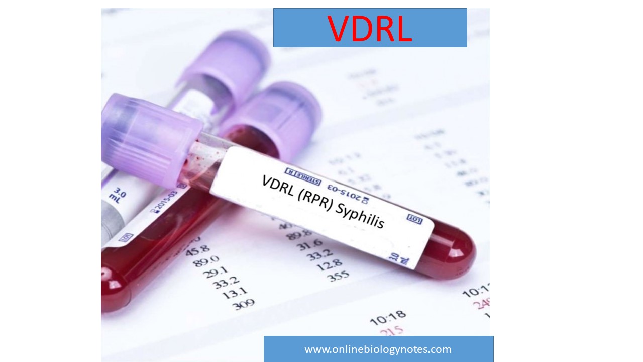 VDRL Test Principle Procedure Result Interpretation And Application