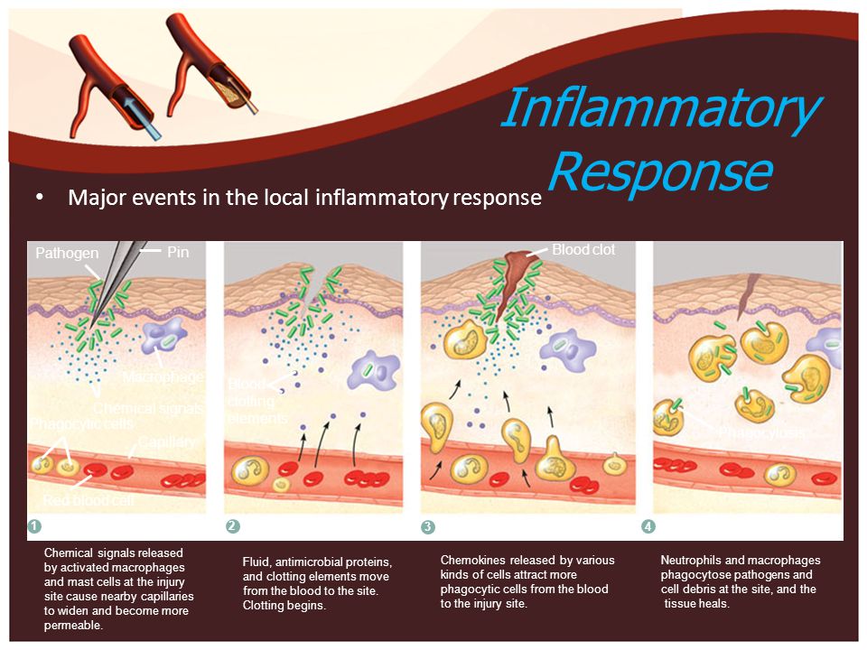 inflammatory response steps
