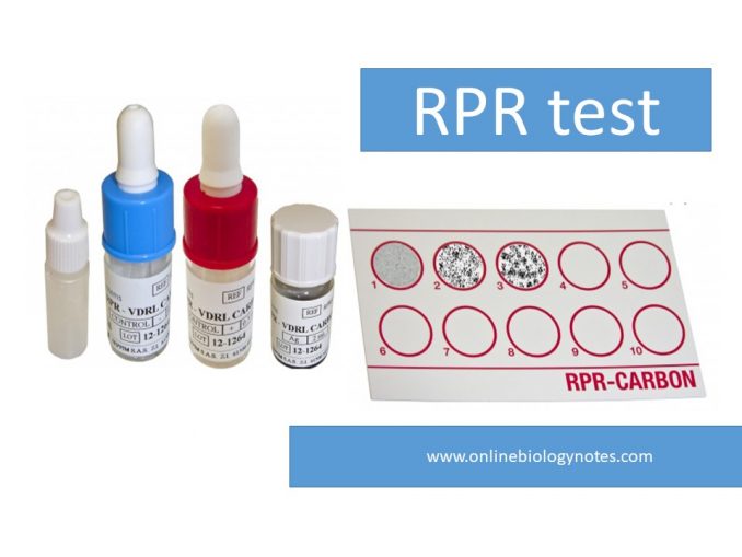 VDRL Test Principle Procedure Result Interpretation And Application Online Biology Notes