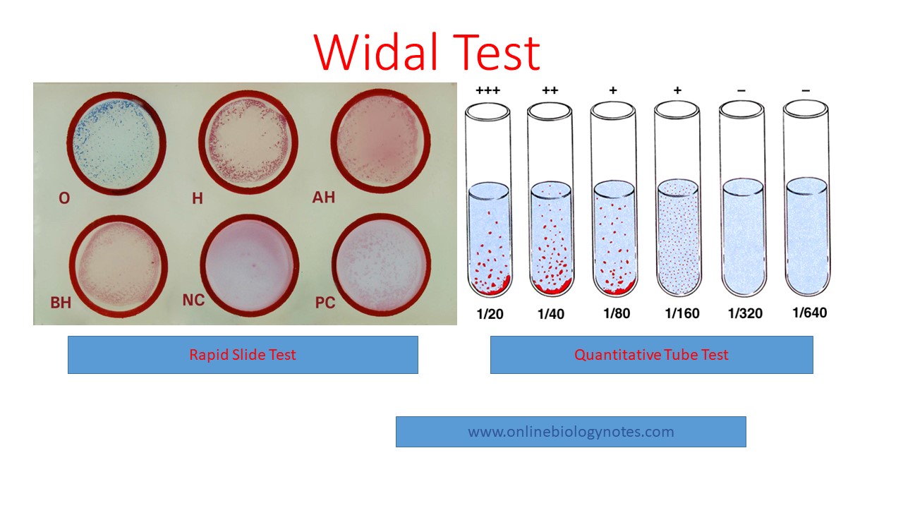 Widal Test Introduction Principle Procedure Result Interpretation 