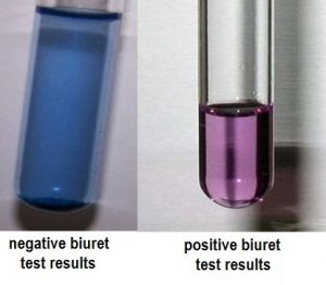 Biuret test-Principle, Requirements, Reagents, Preparation, Procedure ...