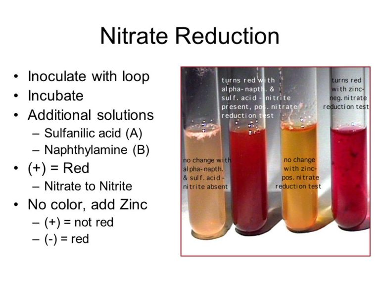 Urease Test Objective Principle Procedure And Result Online Biology Notes 1926