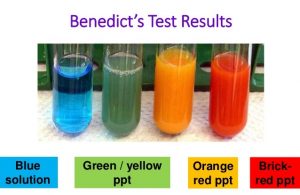 Benedict’s Test: Objective, Principle, Reagents, Procedure and Result ...