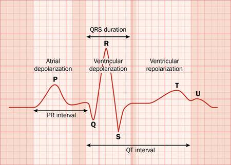 Electrocardiogram Diagram