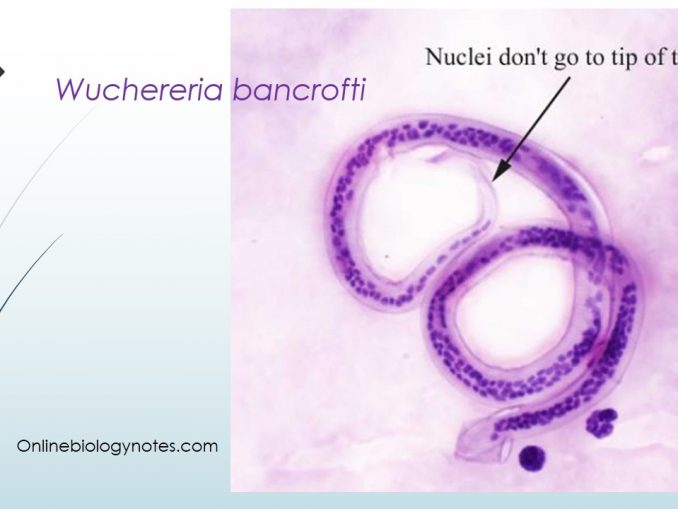 Lymphatic Filariasis (W. Bancrofti): Transmission, Pathogenesis ...